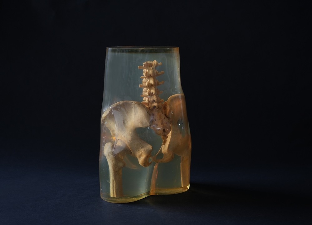 3M Xray Calibration Phantom Pelvis C.1960's