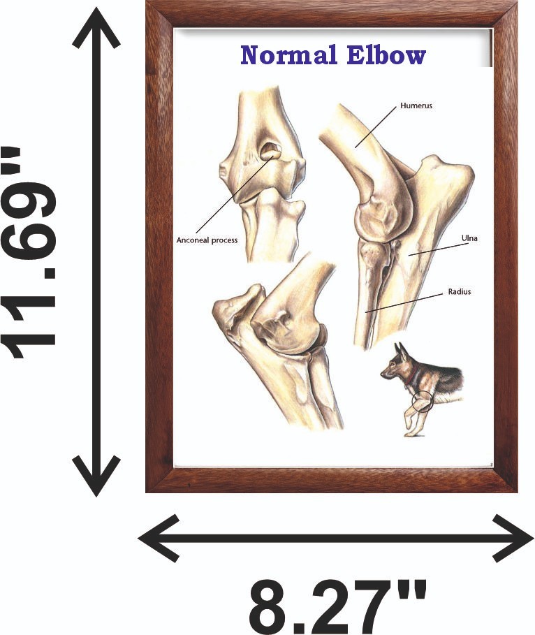 Normal Elbow Chart 12x18 inches