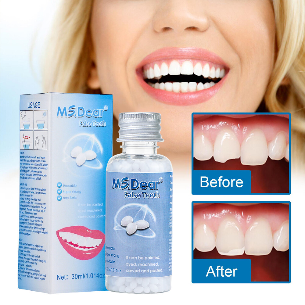 Tooth Repair Granules Temporary Kit Fitting Beads Reusable Moldable False Teeth