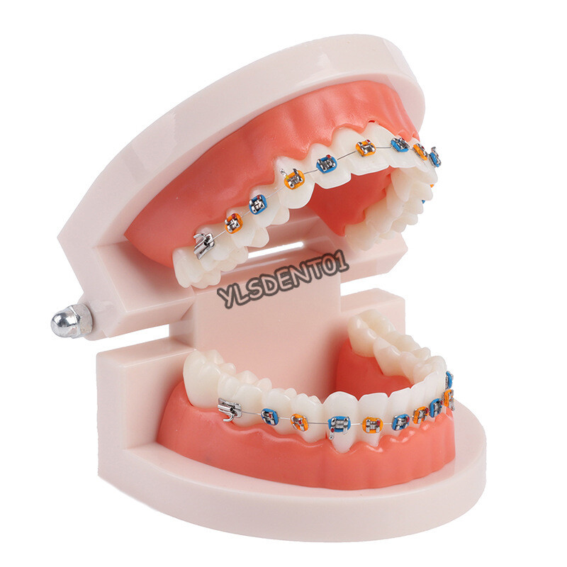 Dental Typodont Orthodontic Treatment Teeth Model Malocclusion Study w/ Bracket
