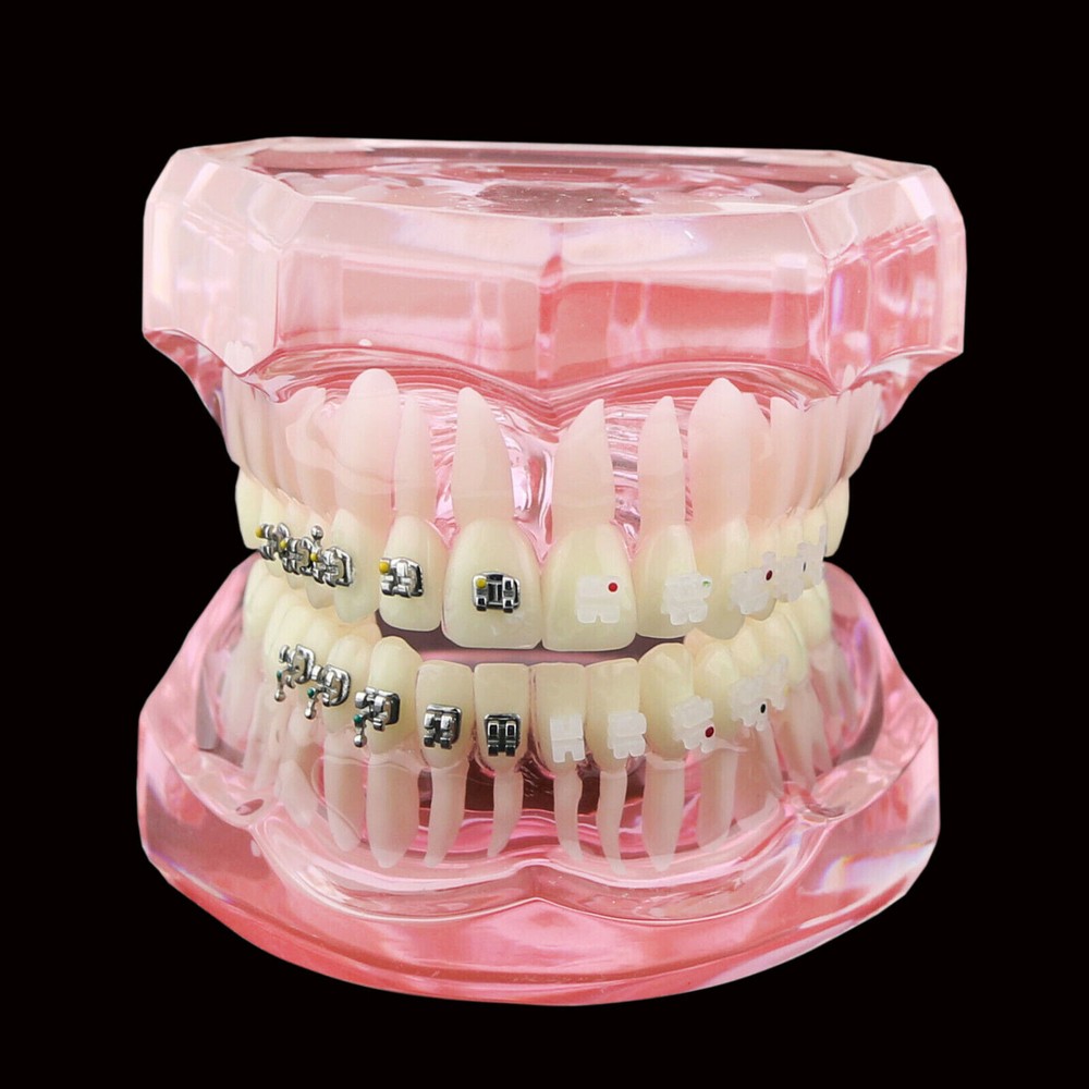 Dental Orthodontic Demonstration Ceramic and Metal Bracket Study Typodont Model