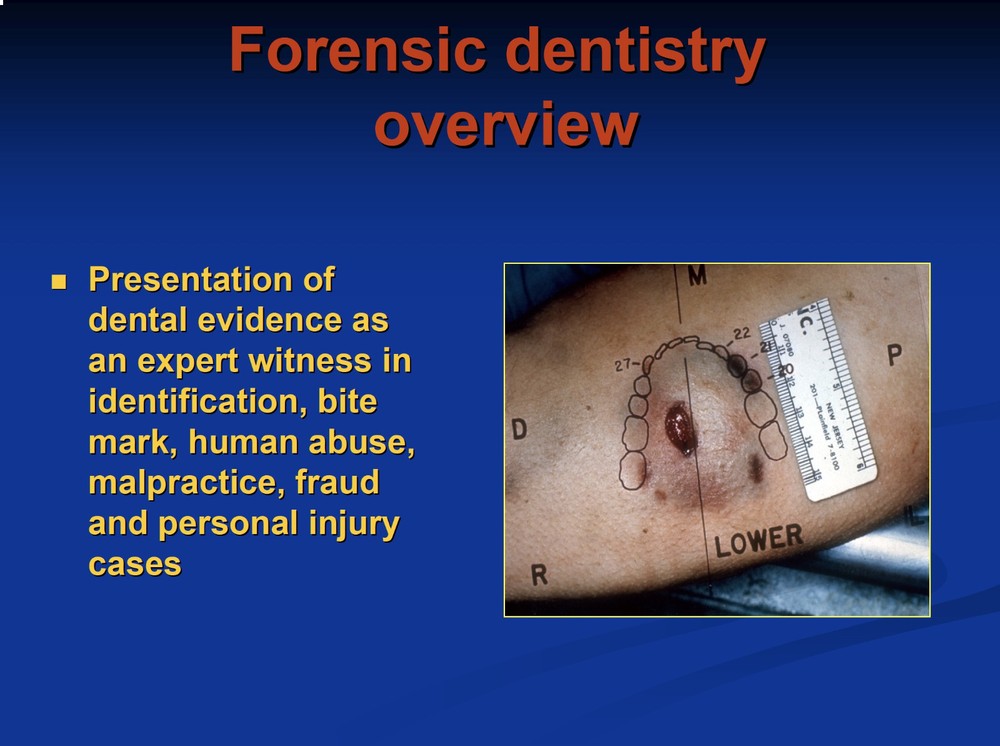 15+ CID CRIME SCENE FORENSICS Death PowerPoint Presentations on CD