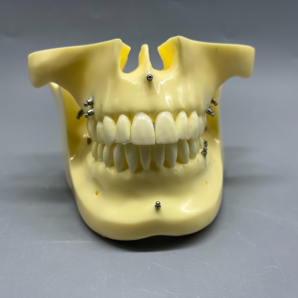 Dental Practice Implant Model Anchorage Nail Practice Model