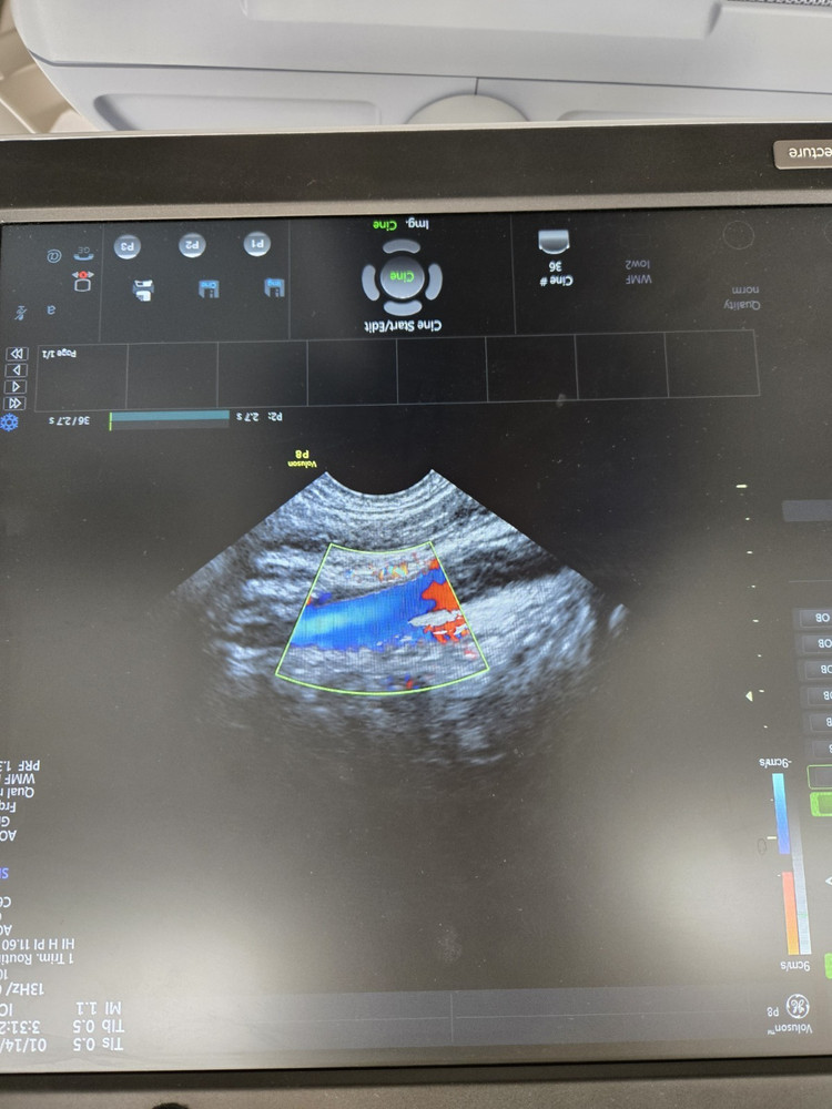 GE IC9-RS Ultrasound Probe / Transducer
