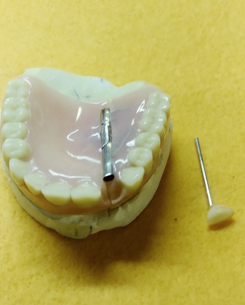 Devided Denture DENTAL DEMONSTRATION TEACHING MODEL Lab Dentist & Oral Surgeon