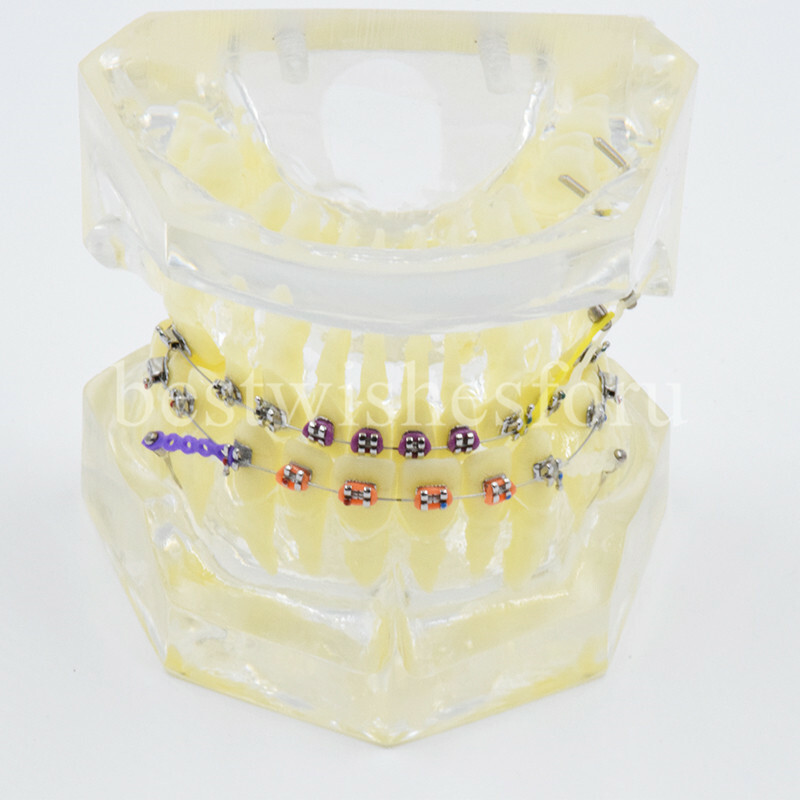 Dental Malocclusion Treatment Teeth Model Study Typodont Elastic chain 3005-2