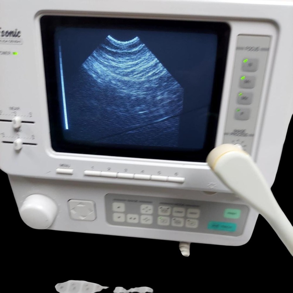 Fukuda UF-4500 Vaginal Probe