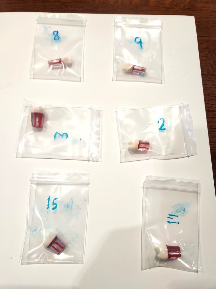 Dental Transparent Root Canal Study Model