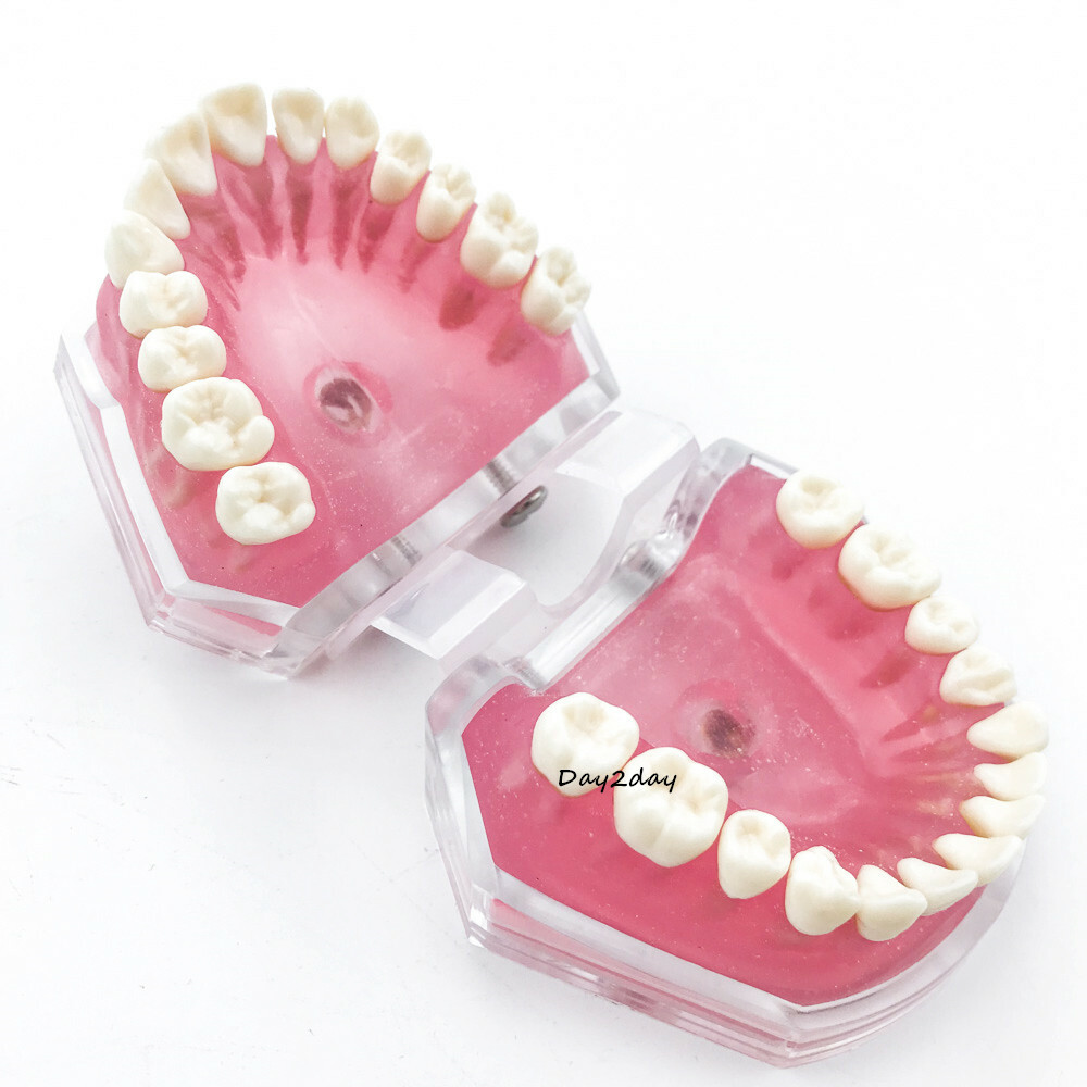 Teeth Model Dental Standard Model with Removable Teeth Dental Study Model