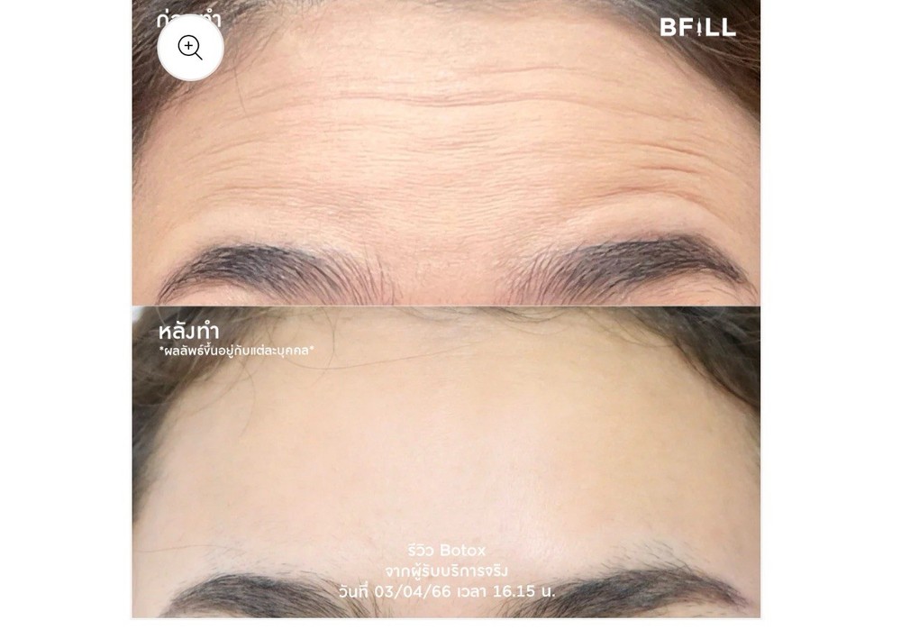 Nabota-100- Authentic- 2 boxes