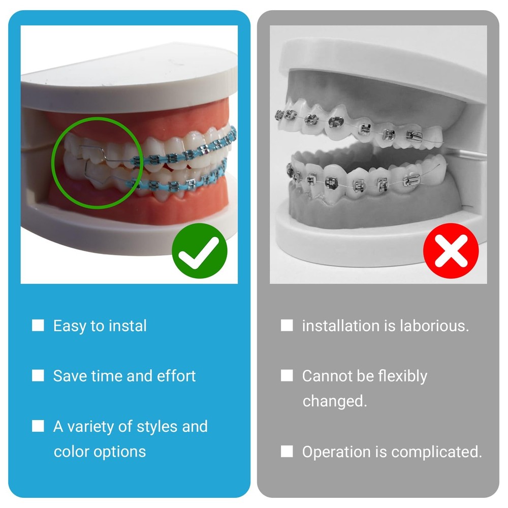 4 Pair of Temporary Tooth Decoration, Teeth Retainer Practical Brackets para ...