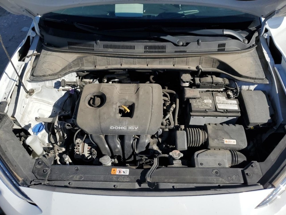 Camera/Projector Camera Windshield Mounted Fits 18-21 KONA 340556