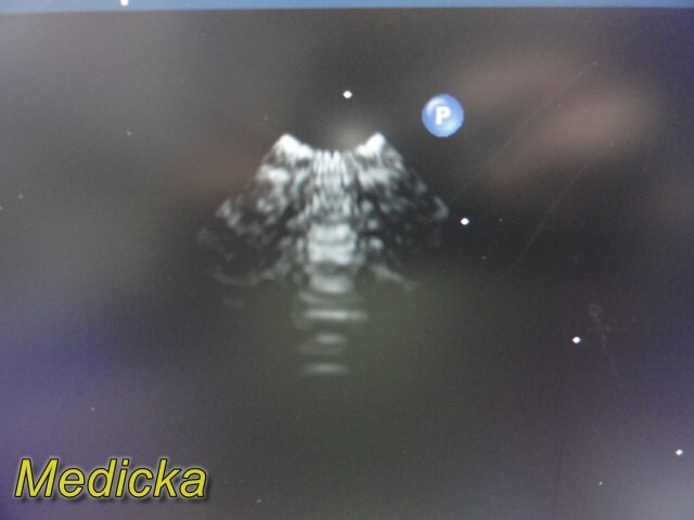 Philips X7-2 Matrix Sector Array Ultrasound Transducer Ref 453561192603 ~ 36256