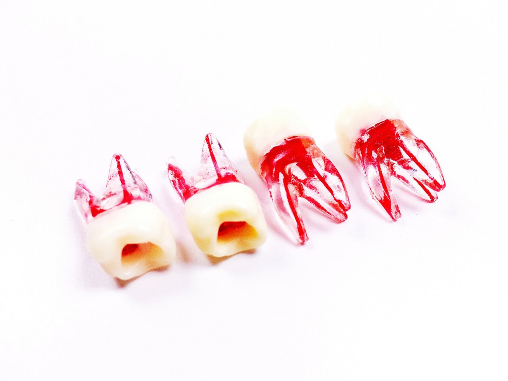 Dental Endo Root Canal File Training Study Model Student Practice Block Red Pulp