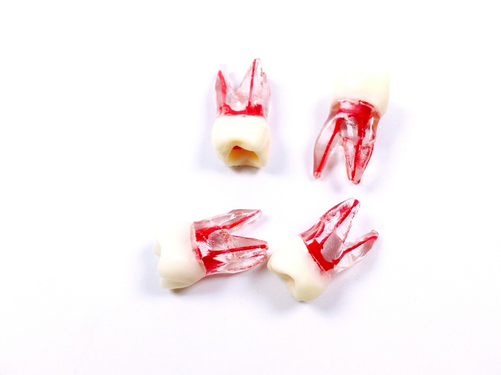 Dental Endo Root Canal File Training Study Model Student Practice Block Red Pulp