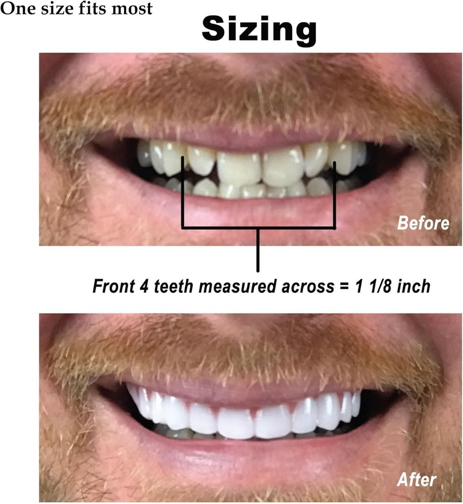 Cosmetic Teeth