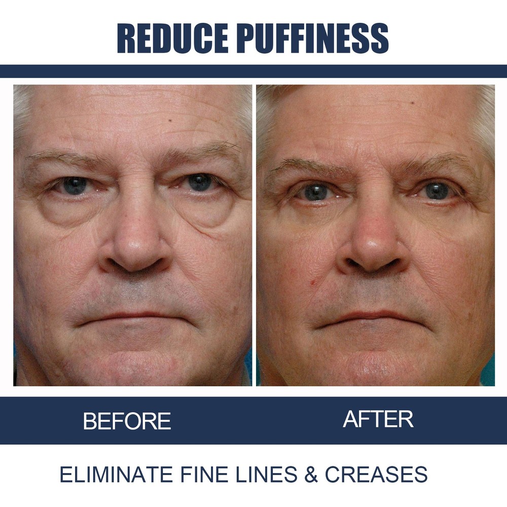 Men's Eye Cream 2pcs