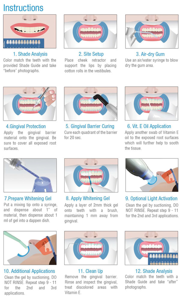 iBrite Chairside Teeth Whitening System (Single Patient)