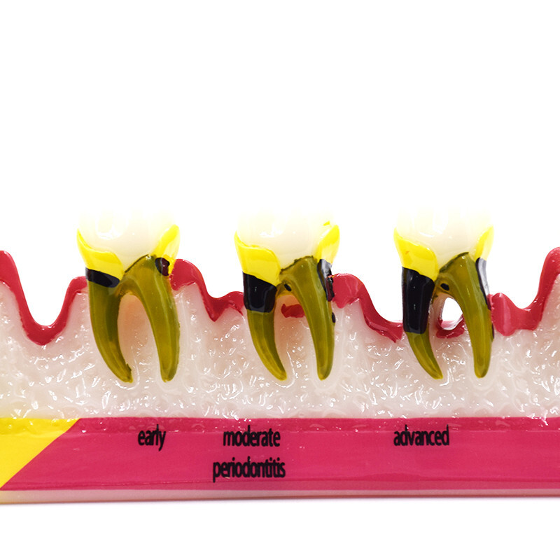 Dental High Quality Assort Dentoform Pathological Study Periodontal Model Teeth
