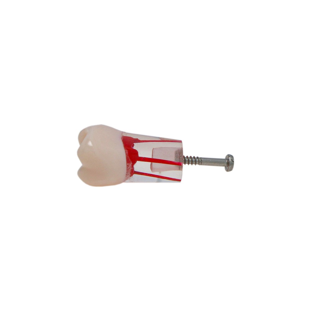10Pcs Dental Root Teeth Canal Pulp Cavity RCT Endodontic Practice Teeth Model