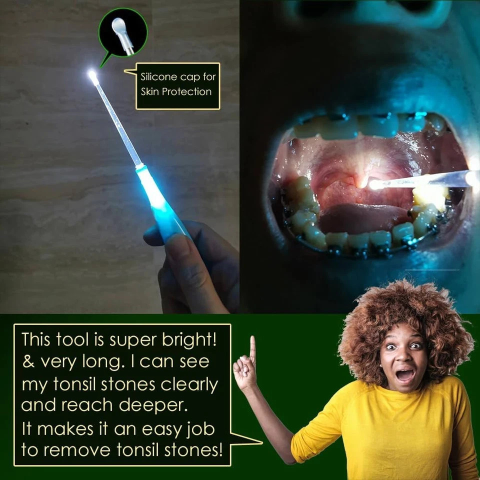 Upgraded 2 Lighted Tonsil Stone Remove Tool Tonsillolith Pick + Irrigation Clean