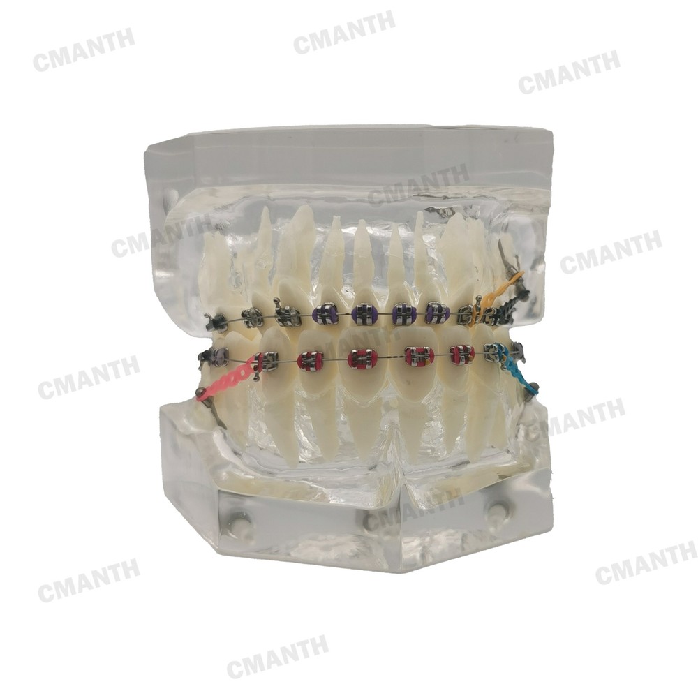 Dental Teeth Model Ceramic Brackets Orthodontic Correction Teaching Model M3005