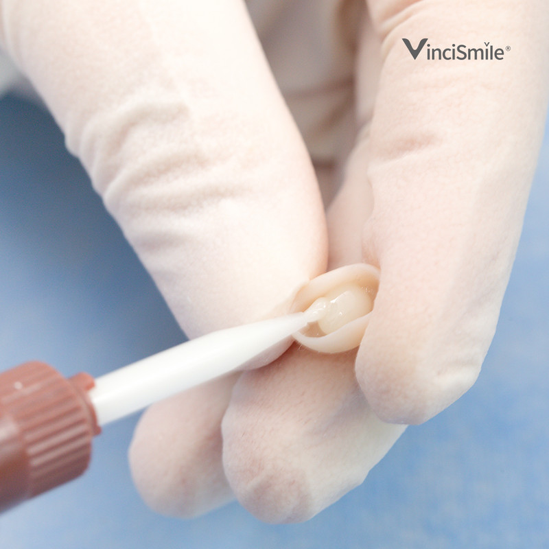 HUGE TOPCEM Veneer System- Veneer Cement Cementation Restorations KIT