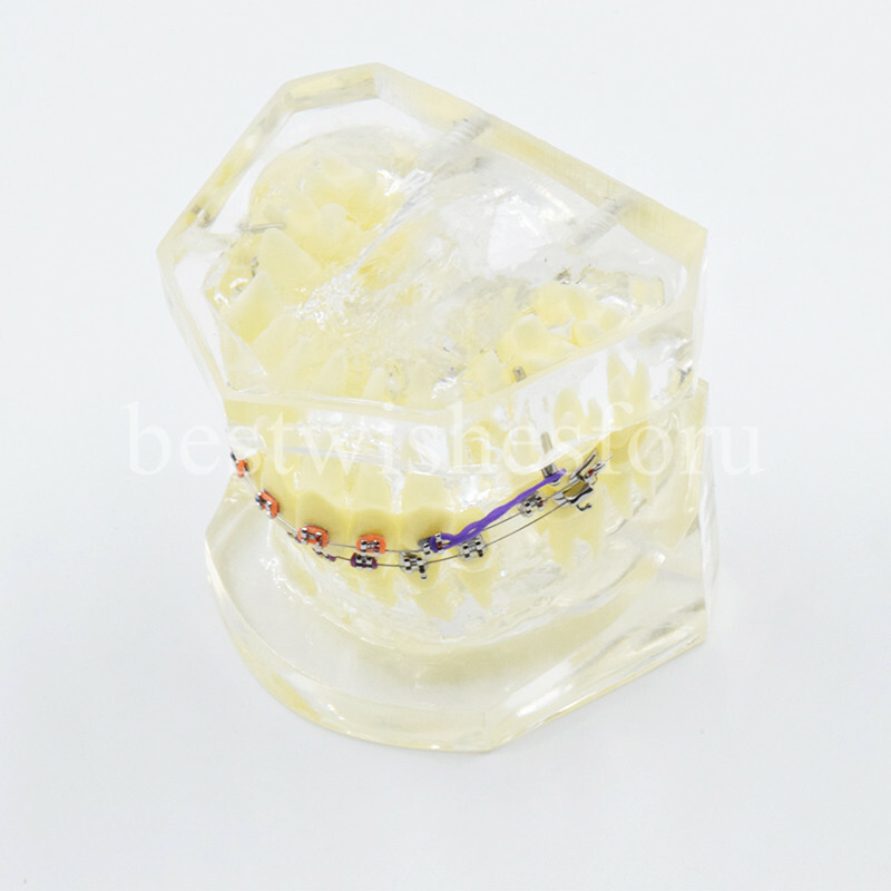 Dental Malocclusion Treatment Teeth Model Study Typodont Elastic chain 3005-2
