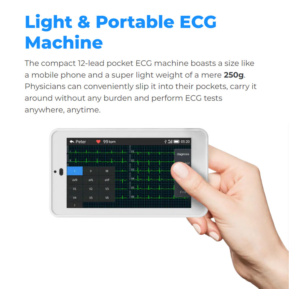 12-Lead ECG Machine Diagnostic Automatic Interpretation data transfer via email