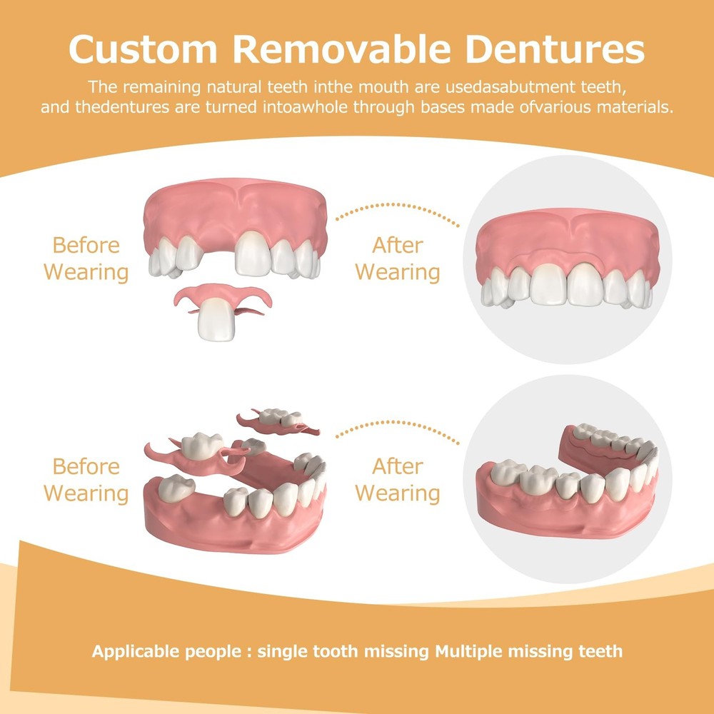 Partial Dentures - for Missing Teeth & Gaps - 1 Tooth, White