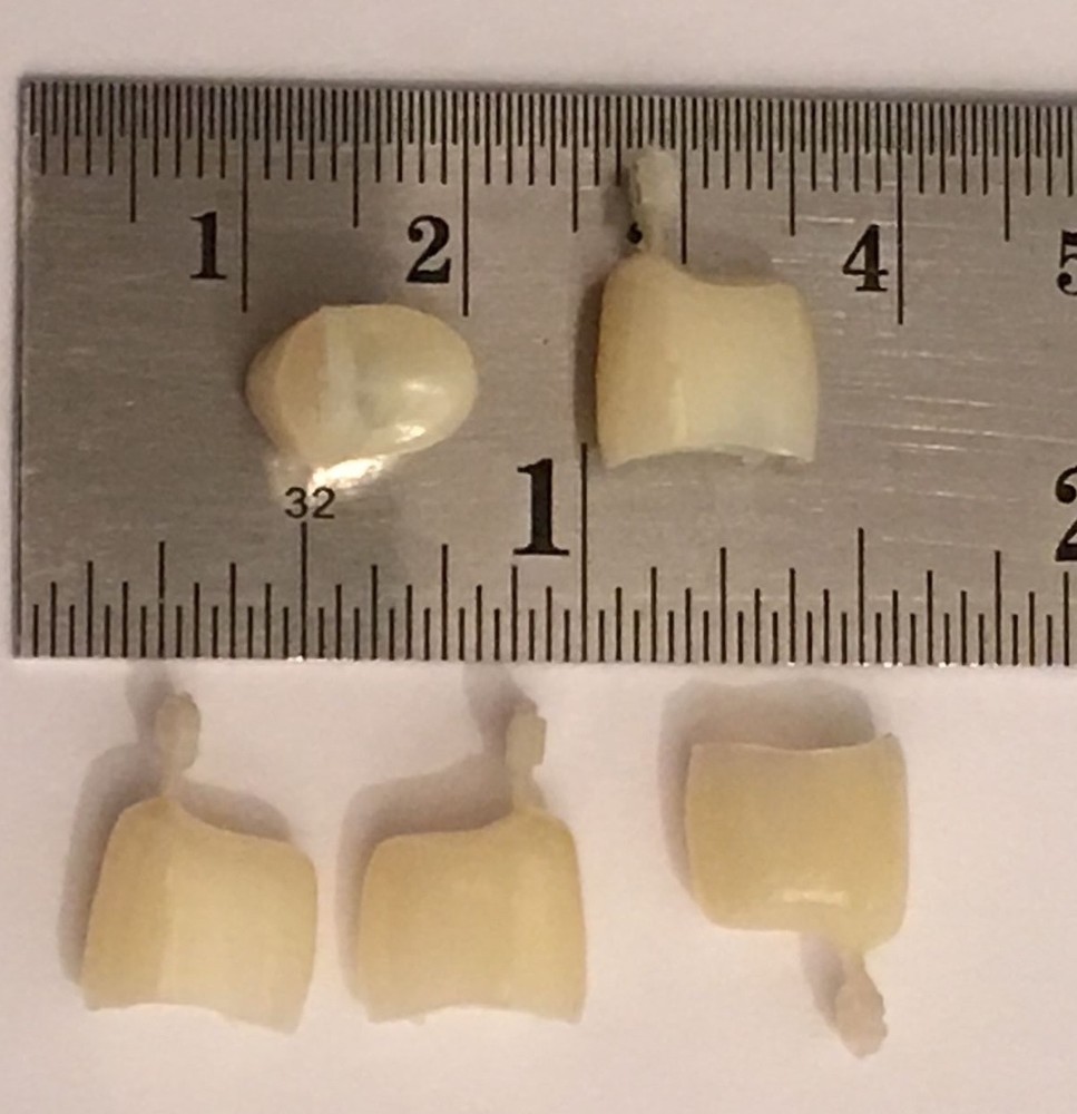 Dental Polycarbonate Temporary Crowns 5 pcs #51