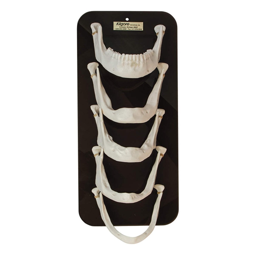 Mandible Bone Loss Model