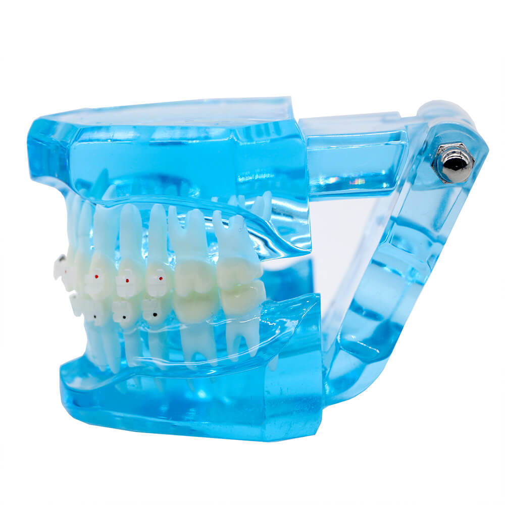Dental orthodontic contrust teach study teeth model mental and ceramic bracket