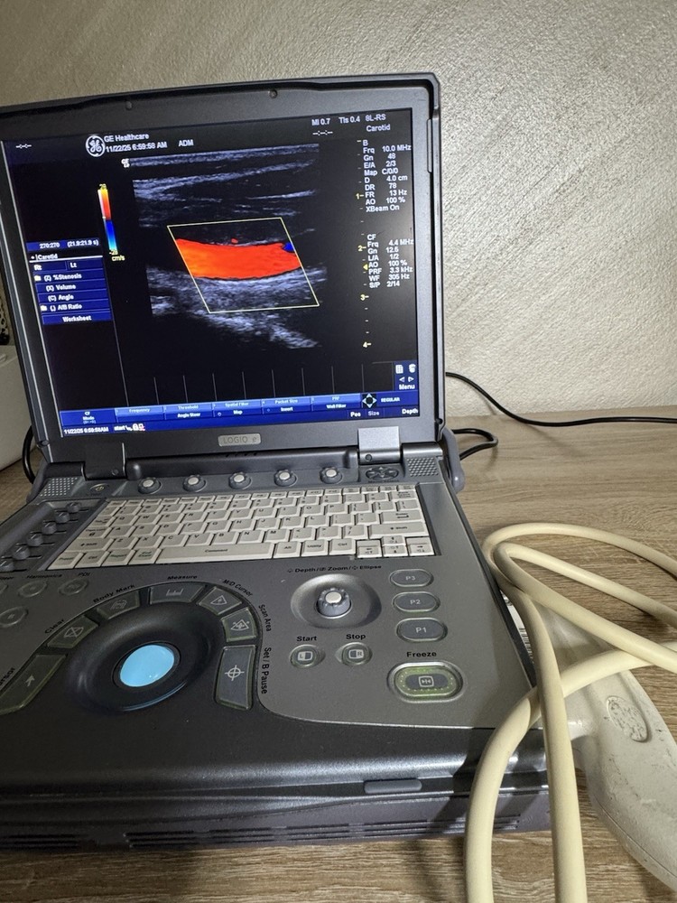 GE 8L-RS Liner Array Ultrasound Probe Transducer