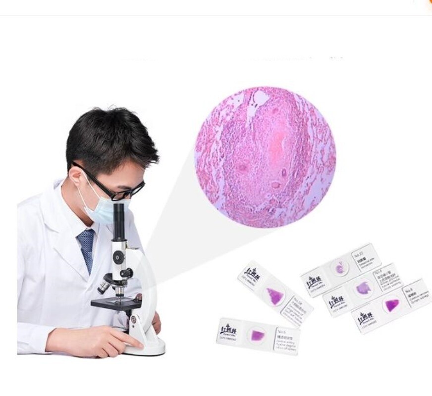 100PCS Mammal Pathological Section Typical Prepared Specimen Slides