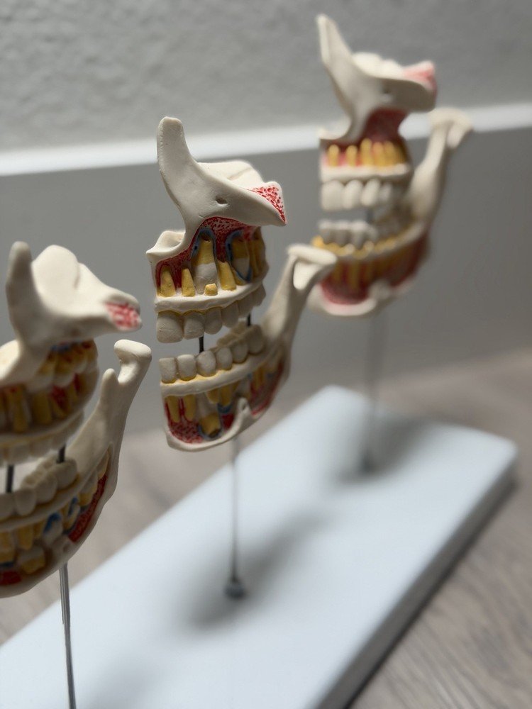 3B Scientific Dentition Development Model - 4 Stages Dental Teeth education