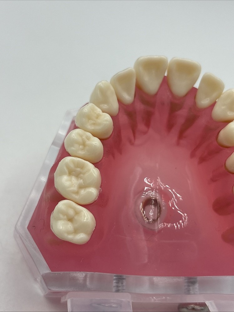 Dental Typodont Practice Removable Teeth Model M7008