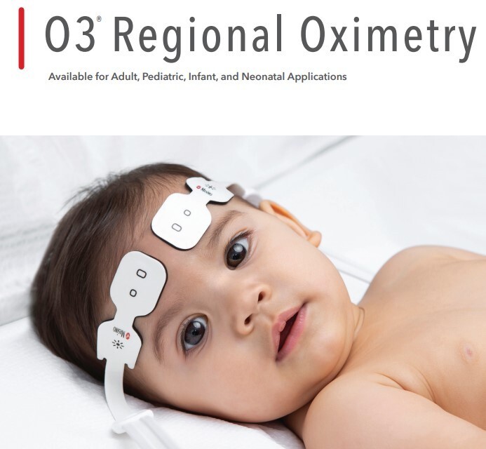 Masimo O3 Regional Oximeter (MOC-9) Module (NEW) REF:4496 - OEM Packaging