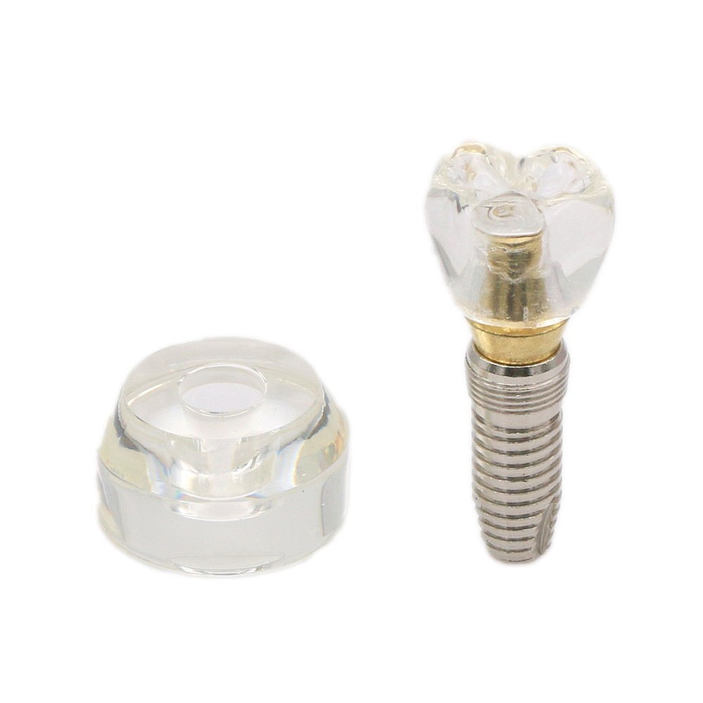 M2020 Dental Implant Model Demonstration Teeth Study Teach Model Removable