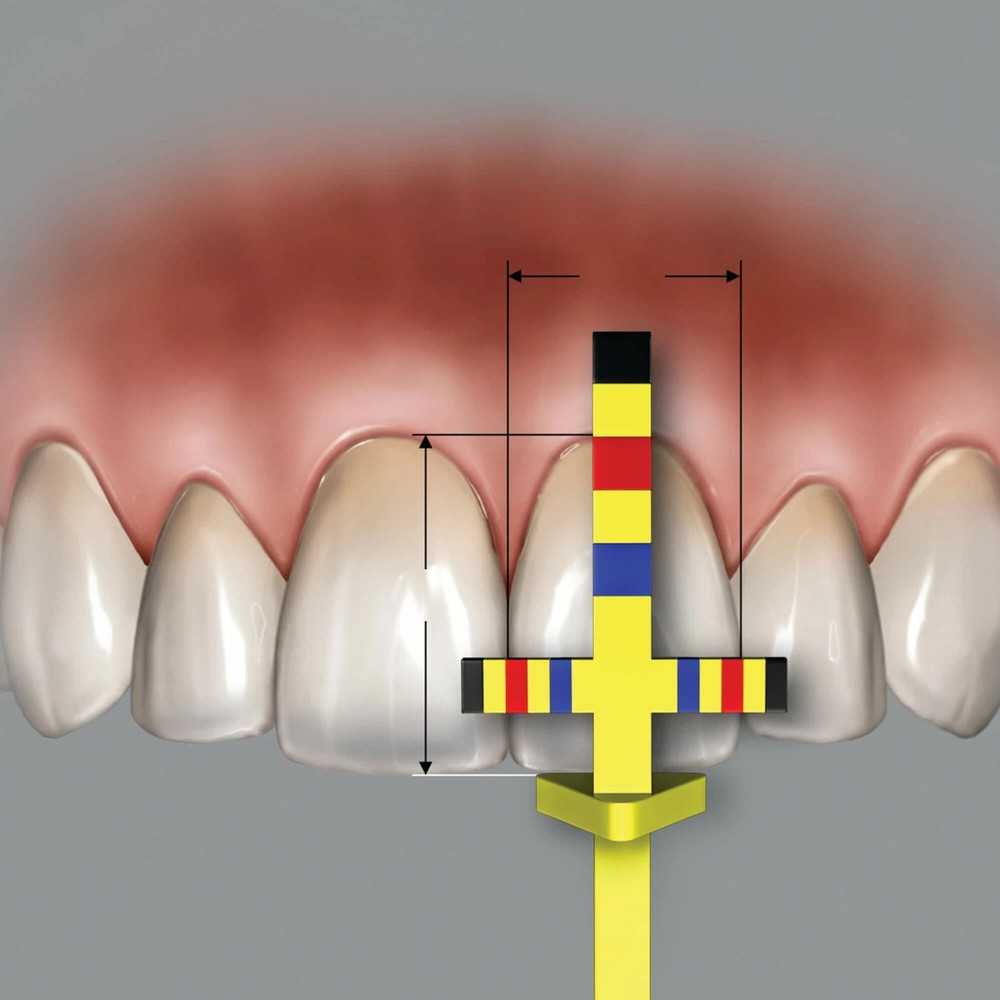 Hu-Friedy T-Bar Replacement Tips (3 Tips) -  TBARREF