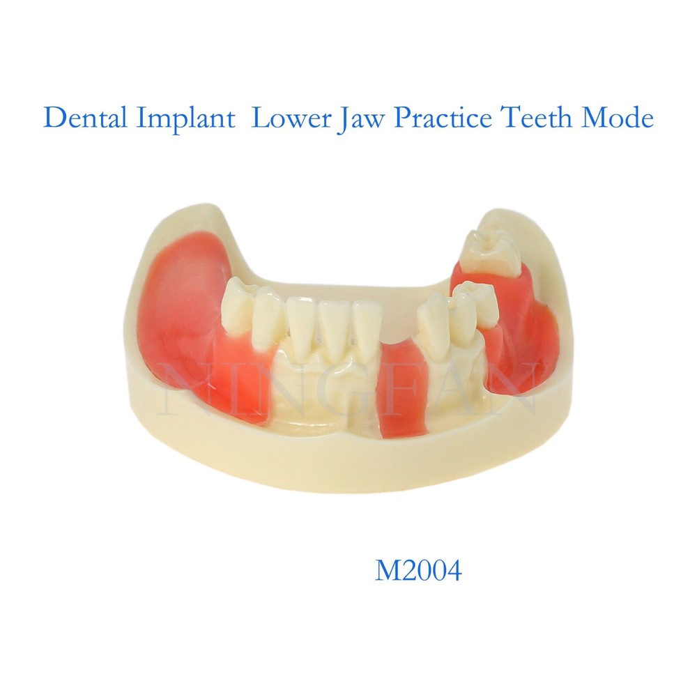 Dental Implant Practice Model, Lower Jaw Drilling, Maxillary Sinus Lifting Type
