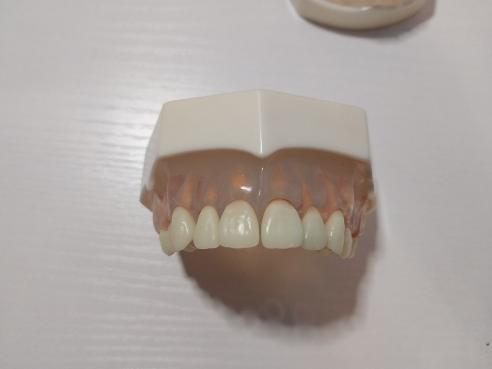 Dental Study Model Acadental