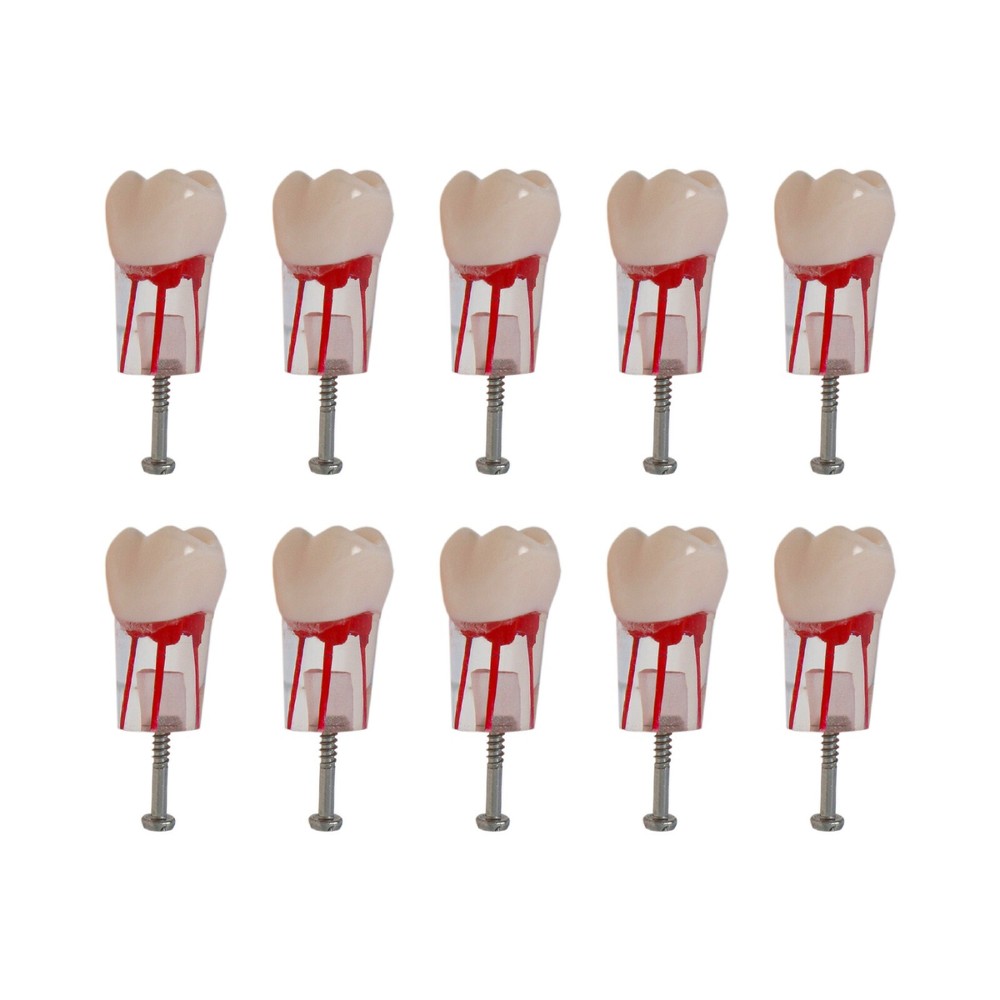 26# (UL6 First Molar) Training Models for Root Canal Procedures Dental Endo Root