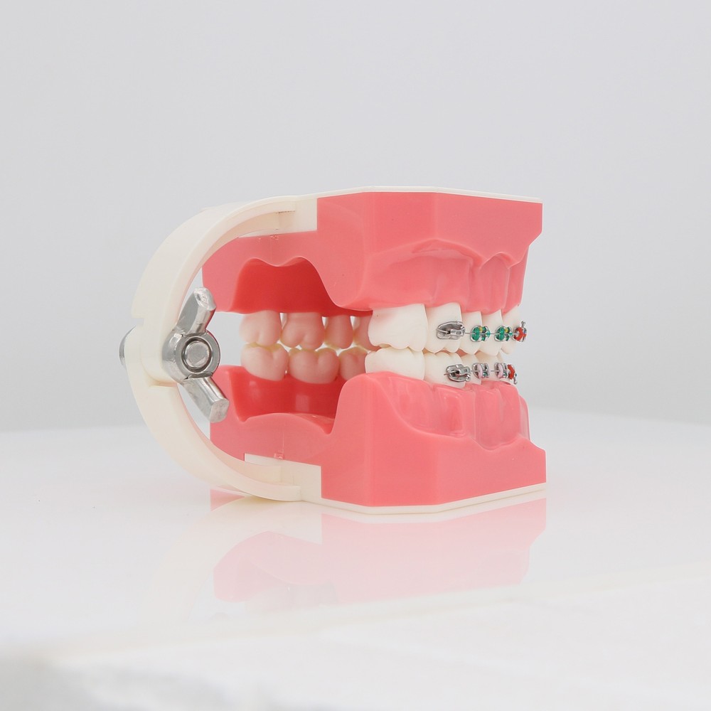 Dental Orthodontic Teeth Model Typodont Demonstration Model with Brackets