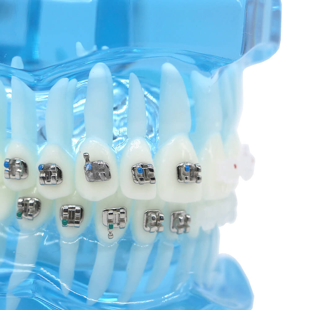 Dental orthodontic contrust teach study teeth model mental and ceramic bracket