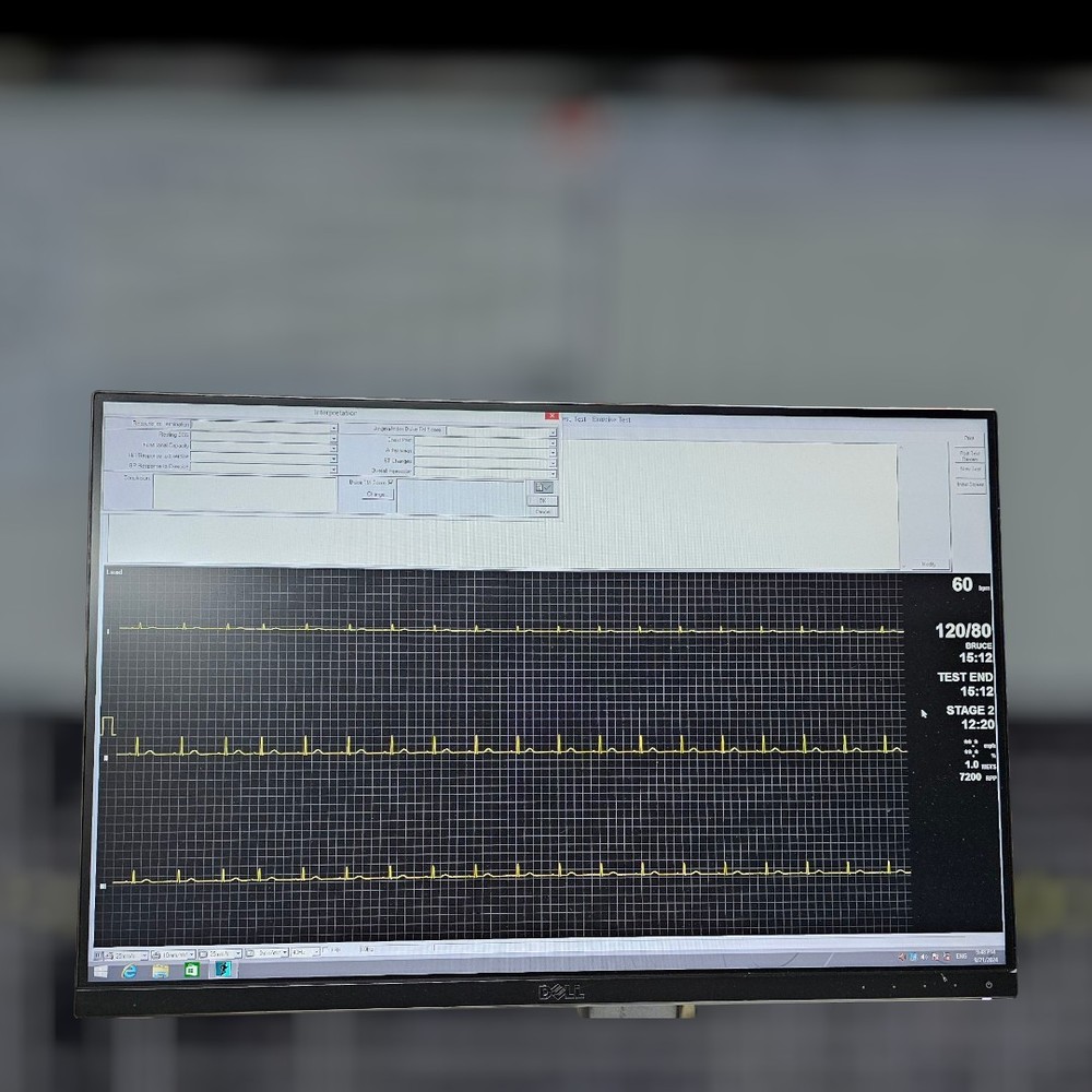 GE Case Stress System Windows 10 Ver.6.73