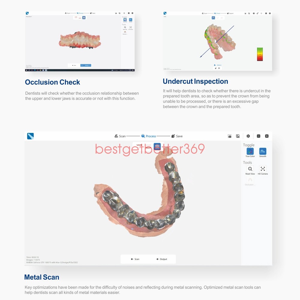 Dental Digital Impression Intraoral 3D Scanner Scanning Software CAD/CAM Process