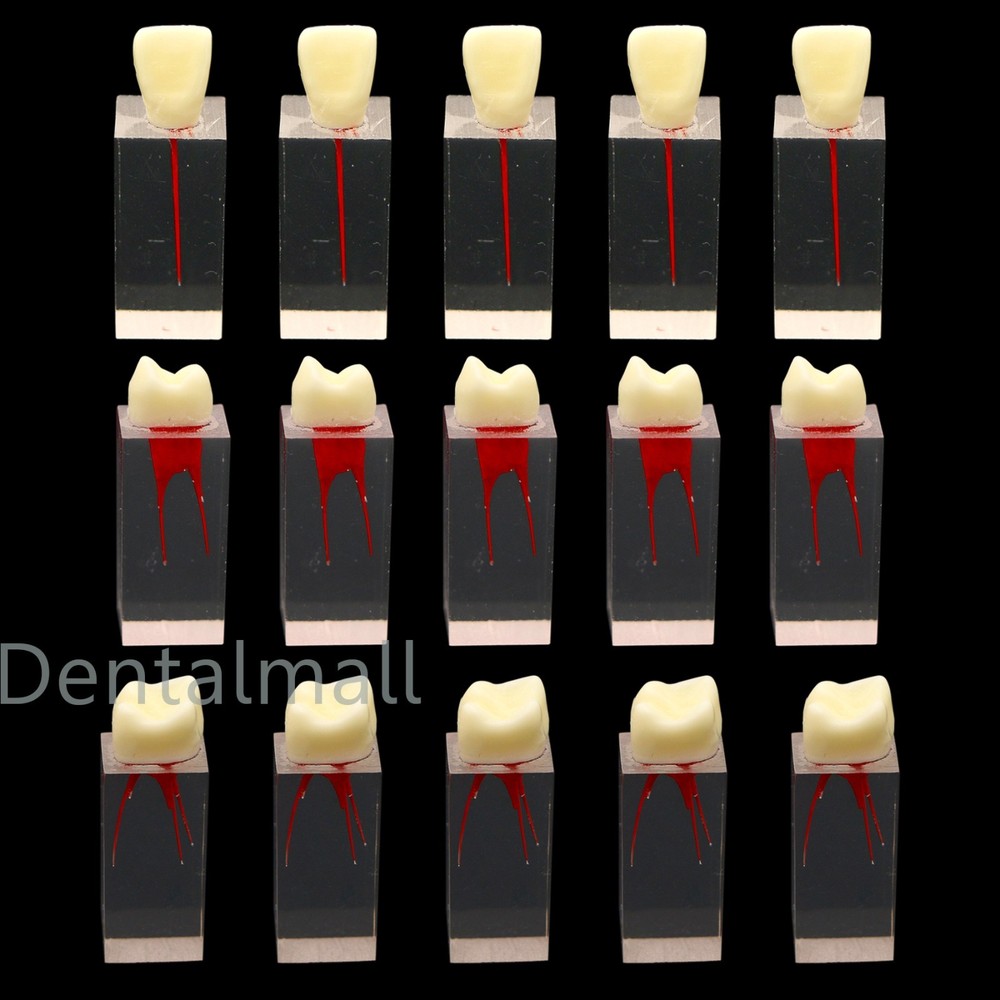 5Pcs Dental Root Canal Teeth molar Model Study Practice For Endodontic Pulp File