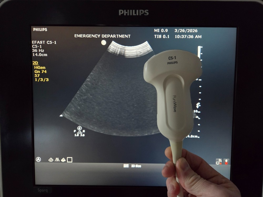 Philips C5-1 Curved Array Transducer - Working - Cord Damage