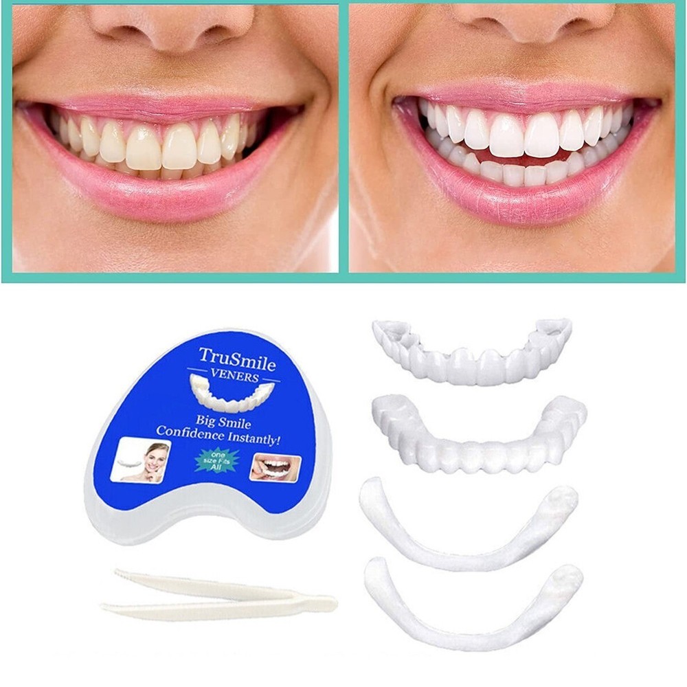 Snap On Veneers Upper & Lower Set - Instant False Teeth Covers No Adhesive buym